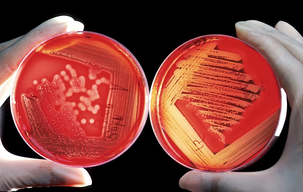 Studie kring vård och resistenta bakterier
